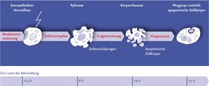 Der Prozess der Apoptose bei der Behandlung mit Oncothermie