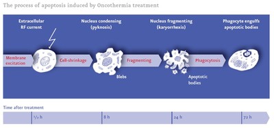The process of apoptosis induced by Oncothermia treatment