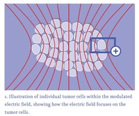 1. Illustration of individual tumor cells within the modulated electric fi eld, showing how the electric fi eld focuses on the tumor cells.